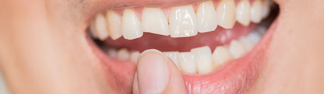 When Should You See an Emergency Dentist in Parma Heights OH? Signs You Shouldn’t Ignore